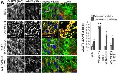 Immunofluorescence - Anti-Glucose Transporter GLUT1 antibody (AB15309)