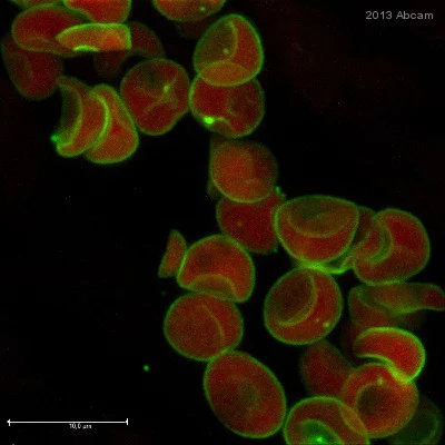 Immunohistochemistry (Formalin/PFA-fixed paraffin-embedded sections) - Anti-Glucose Transporter GLUT1 antibody (AB15309)