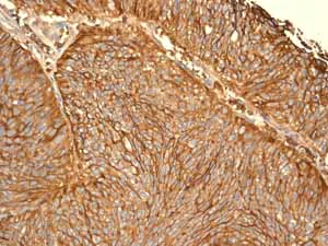Immunohistochemistry (Formalin/PFA-fixed paraffin-embedded sections) - Anti-Glucose Transporter GLUT1 antibody [EPR3915] (AB115730)