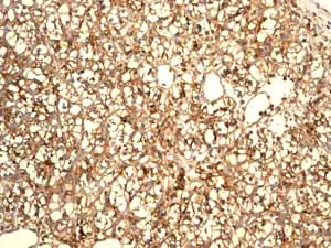 Immunohistochemistry (Formalin/PFA-fixed paraffin-embedded sections) - Anti-Glucose Transporter GLUT1 antibody [EPR3915] (AB115730)