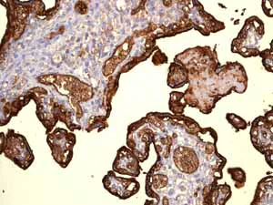 Immunohistochemistry (Formalin/PFA-fixed paraffin-embedded sections) - Anti-Glucose Transporter GLUT1 antibody [EPR3915] (AB115730)