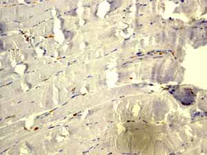 Immunohistochemistry (Formalin/PFA-fixed paraffin-embedded sections) - Anti-Glucose Transporter GLUT1 antibody [EPR3915] (AB115730)