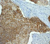 Immunohistochemistry (Formalin/PFA-fixed paraffin-embedded sections) - Anti-Glucose Transporter GLUT1 antibody [EPR3915] (AB115730)