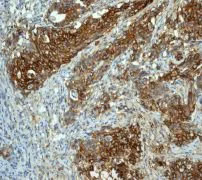 Immunohistochemistry (Formalin/PFA-fixed paraffin-embedded sections) - Anti-Glucose Transporter GLUT1 antibody [EPR3915] (AB115730)