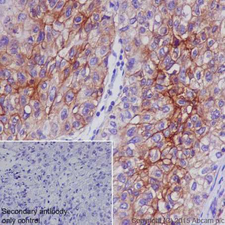 Immunohistochemistry (Formalin/PFA-fixed paraffin-embedded sections) - Anti-Glucose Transporter GLUT1 antibody [EPR3915] (AB115730)