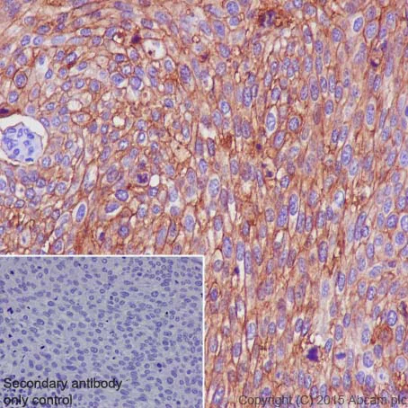 Immunohistochemistry (Formalin/PFA-fixed paraffin-embedded sections) - Anti-Glucose Transporter GLUT1 antibody [EPR3915] (AB115730)