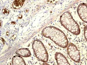 Immunohistochemistry (Formalin/PFA-fixed paraffin-embedded sections) - Anti-Glucose Transporter GLUT1 antibody [EPR3915] (AB115730)