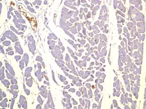 Immunohistochemistry (Formalin/PFA-fixed paraffin-embedded sections) - Anti-Glucose Transporter GLUT1 antibody [EPR3915] (AB115730)