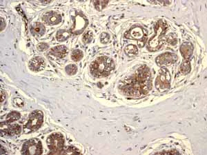Immunohistochemistry (Formalin/PFA-fixed paraffin-embedded sections) - Anti-Glucose Transporter GLUT1 antibody [EPR3915] (AB115730)