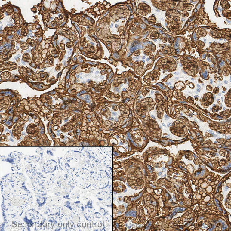 Immunohistochemistry - Anti-Glucose Transporter GLUT1 antibody [EPR3915] (AB115730)