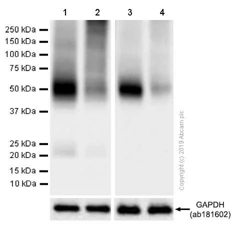 Western blot - Anti-Glucose Transporter GLUT1 antibody [EPR3915] (AB115730)