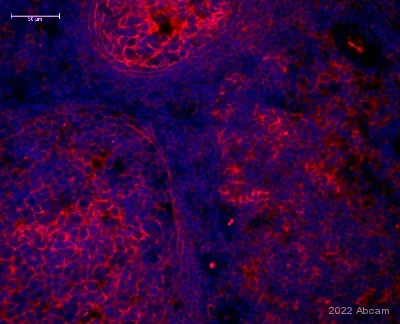 Immunohistochemistry (Formalin/PFA-fixed paraffin-embedded sections) - Anti-Glucose Transporter GLUT1 antibody [EPR3915] - BSA and Azide free (AB252403)