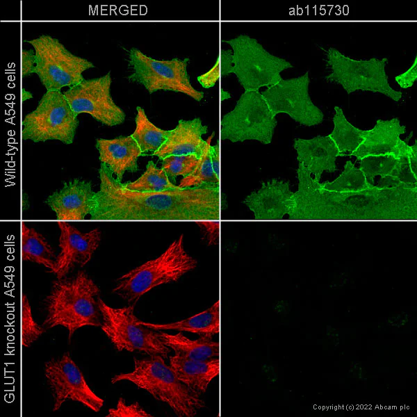 Immunocytochemistry/ Immunofluorescence - Anti-Glucose Transporter GLUT1 antibody [EPR3915] - Low endotoxin, Azide free (AB196357)