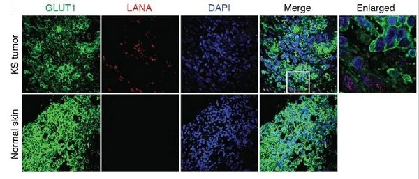 Immunohistochemistry (Formalin/PFA-fixed paraffin-embedded sections) - Anti-Glucose Transporter GLUT1 antibody [EPR3915] - Low endotoxin, Azide free (AB196357)