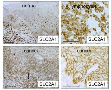 Immunohistochemistry (Formalin/PFA-fixed paraffin-embedded sections) - Anti-Glucose Transporter GLUT1 antibody [EPR3915] - Low endotoxin, Azide free (AB196357)