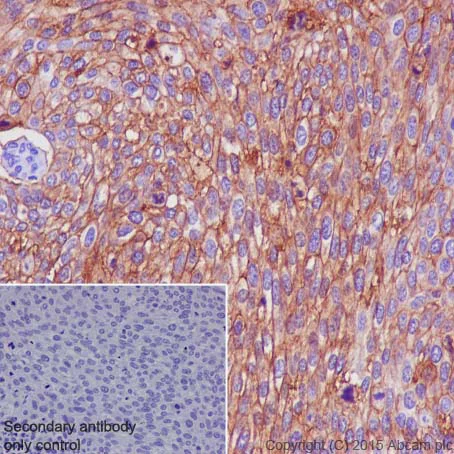 Immunohistochemistry (Formalin/PFA-fixed paraffin-embedded sections) - Anti-Glucose Transporter GLUT1 antibody [EPR3915] - Low endotoxin, Azide free (AB196357)