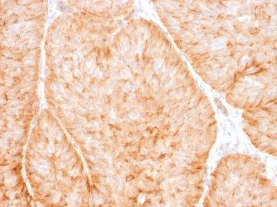 Immunohistochemistry (Formalin/PFA-fixed paraffin-embedded sections) - Anti-Glucose Transporter GLUT1 antibody [GLUT1/2475] (AB238050), expandable thumbnail