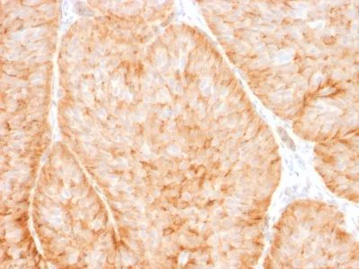 Immunohistochemistry (Formalin/PFA-fixed paraffin-embedded sections) - Anti-Glucose Transporter GLUT1 antibody [GLUT1/2475] (AB238050)