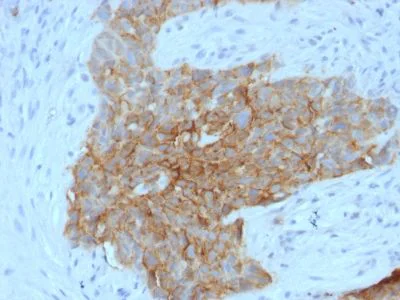 Immunohistochemistry (Formalin/PFA-fixed paraffin-embedded sections) - Anti-Glucose Transporter GLUT1 antibody [GLUT1/2475] (AB238050)