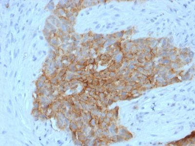 Immunohistochemistry (Formalin/PFA-fixed paraffin-embedded sections) - Anti-Glucose Transporter GLUT1 antibody [GLUT1/2475] - BSA and Azide free (AB237900)
