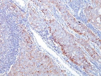 Immunohistochemistry (Formalin/PFA-fixed paraffin-embedded sections) - Anti-Glucose Transporter GLUT1 antibody [GLUT1/2476] (AB238051)