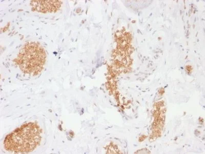 Immunohistochemistry (Formalin/PFA-fixed paraffin-embedded sections) - Anti-Glucose Transporter GLUT1 antibody [GLUT1/2476] (AB238051)