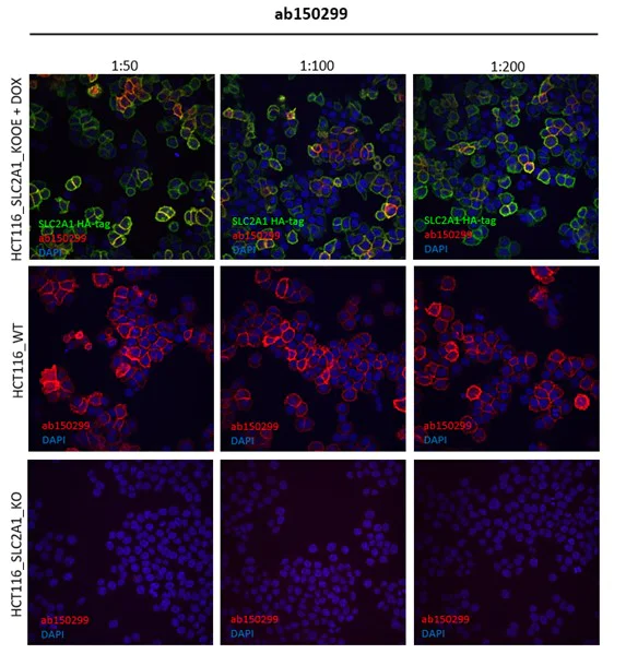 Immunocytochemistry/ Immunofluorescence - Anti-Glucose Transporter GLUT1 antibody [SP168] (AB150299)