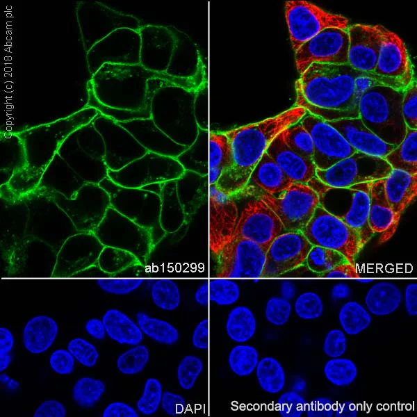 Immunocytochemistry/ Immunofluorescence - Anti-Glucose Transporter GLUT1 antibody [SP168] (AB150299)
