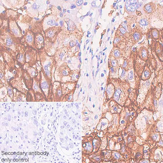 Immunohistochemistry (Formalin/PFA-fixed paraffin-embedded sections) - Anti-Glucose Transporter GLUT1 antibody [SP168] (AB150299)