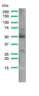 Western blot - Anti-Glucose Transporter GLUT1 antibody [SP168] (AB150299)
