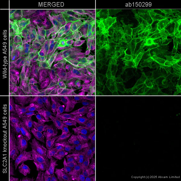 Immunocytochemistry/ Immunofluorescence - Anti-Glucose Transporter GLUT1 antibody [SP168] - BSA and Azide free (AB243915)