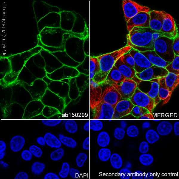 Anti-Glucose Transporter GLUT1 antibody [SP168] - BSA and Azide