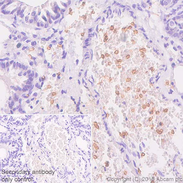 Immunohistochemistry (Formalin/PFA-fixed paraffin-embedded sections) - Anti-Glucose Transporter GLUT1 antibody [SP168] - BSA and Azide free (AB243915)
