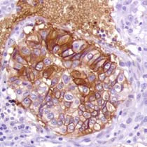Immunohistochemistry (Formalin/PFA-fixed paraffin-embedded sections) - Anti-Glucose Transporter GLUT1 antibody [SP168] - BSA and Azide free (AB243915)