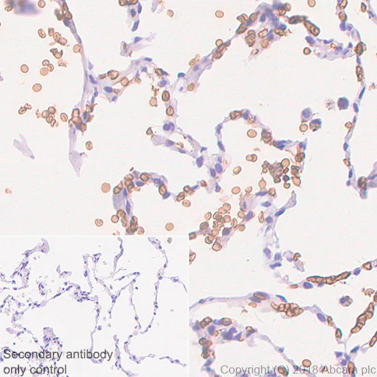 Immunohistochemistry (Formalin/PFA-fixed paraffin-embedded sections) - Anti-Glucose Transporter GLUT1 antibody [SP168] - BSA and Azide free (AB243915)