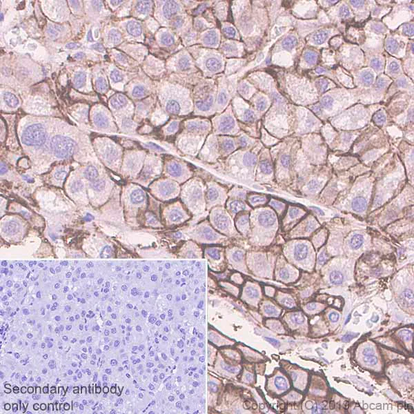 Immunohistochemistry (Formalin/PFA-fixed paraffin-embedded sections) - Anti-Glucose Transporter GLUT2 antibody [EPR22946-74] (AB234440)