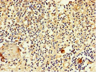 Immunohistochemistry (Formalin/PFA-fixed paraffin-embedded sections) - Anti-Glucose Transporter GLUT3 antibody (AB234756)