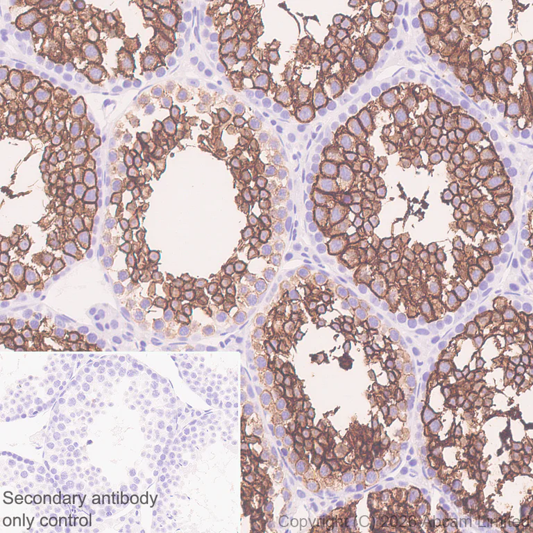 Immunohistochemistry (Formalin/PFA-fixed paraffin-embedded sections) - Anti-Glucose Transporter GLUT3 antibody [EPR30042-14] (AB327003)
