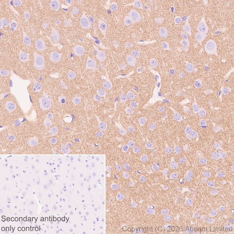 Immunohistochemistry (Formalin/PFA-fixed paraffin-embedded sections) - Anti-Glucose Transporter GLUT3 antibody [EPR30042-14] (AB327003)