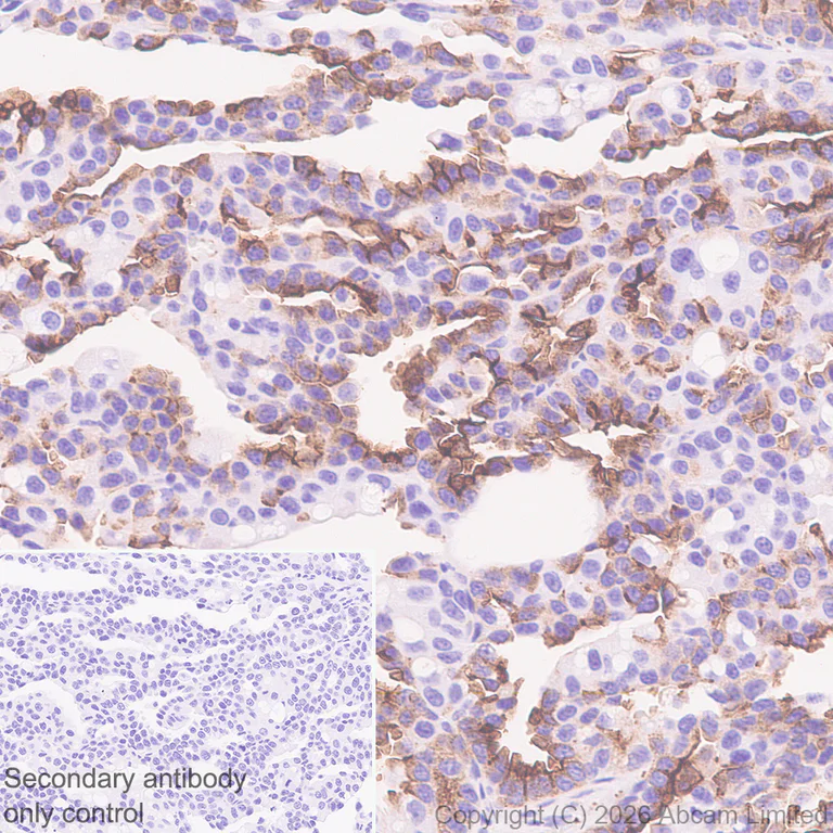 Immunohistochemistry (Formalin/PFA-fixed paraffin-embedded sections) - Anti-Glucose Transporter GLUT3 antibody [EPR30042-14] (AB327003)