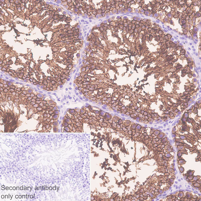 Immunohistochemistry (Formalin/PFA-fixed paraffin-embedded sections) - Anti-Glucose Transporter GLUT3 antibody [EPR30042-14] (AB327003)