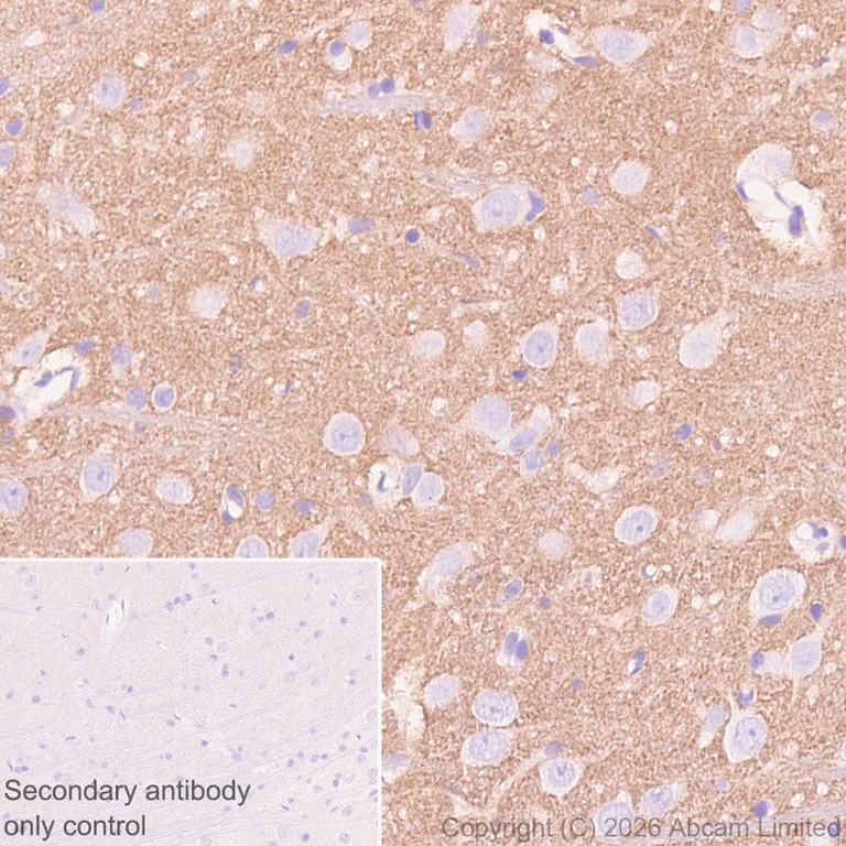 Immunohistochemistry (Formalin/PFA-fixed paraffin-embedded sections) - Anti-Glucose Transporter GLUT3 antibody [EPR30042-14] (AB327003)