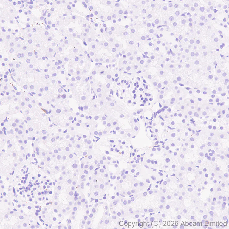 Immunohistochemistry (Formalin/PFA-fixed paraffin-embedded sections) - Anti-Glucose Transporter GLUT3 antibody [EPR30042-14] (AB327003)