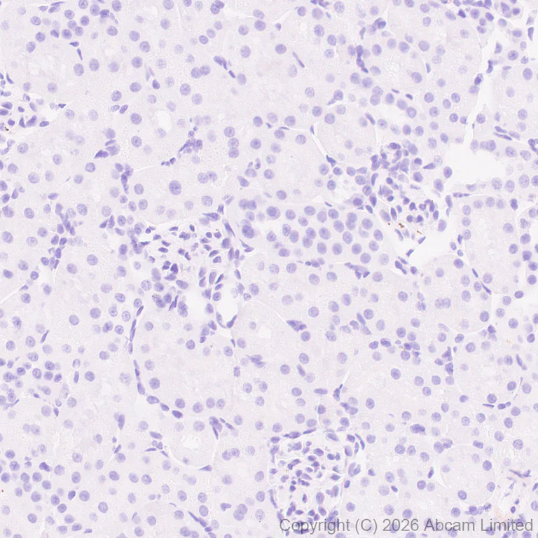 Immunohistochemistry (Formalin/PFA-fixed paraffin-embedded sections) - Anti-Glucose Transporter GLUT3 antibody [EPR30042-14] (AB327003)