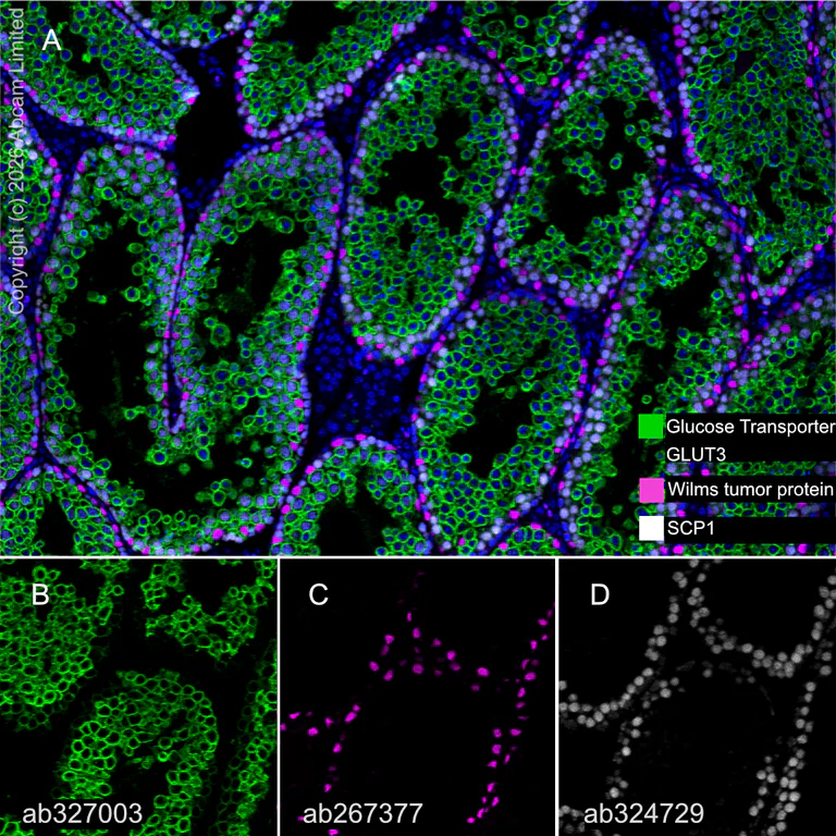 Multiplex immunohistochemistry - Anti-Glucose Transporter GLUT3 antibody [EPR30042-14] (AB327003)