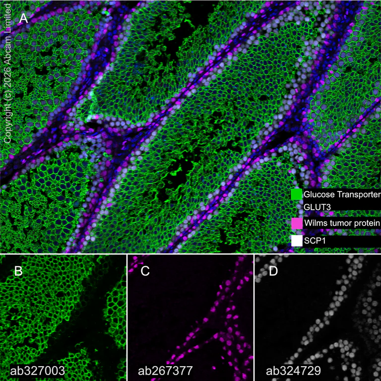 Multiplex immunohistochemistry - Anti-Glucose Transporter GLUT3 antibody [EPR30042-14] (AB327003)