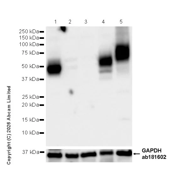 Western blot - Anti-Glucose Transporter GLUT3 antibody [EPR30042-14] (AB327003)