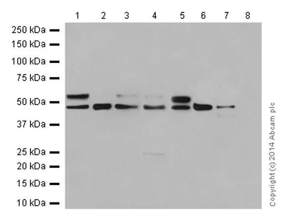 Western blot - Anti-Glucose Transporter GLUT3 + GLUT14 antibody [EPR10508(N)] - N-terminal (AB191071)