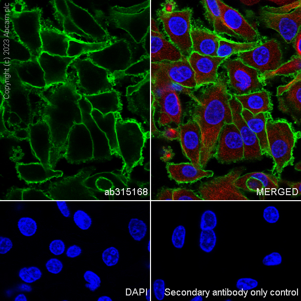 Immunocytochemistry/ Immunofluorescence - Anti-Glucose Transporter GLUT3 + GLUT14 antibody [EPR28481-54] (ab315168), expandable thumbnail