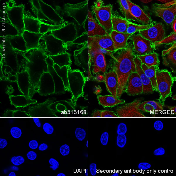 Immunocytochemistry/ Immunofluorescence - Anti-Glucose Transporter GLUT3 + GLUT14 antibody [EPR28481-54] (AB315168)